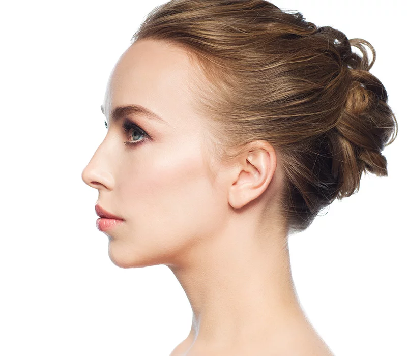 Rhinoplasty Swelling Stages