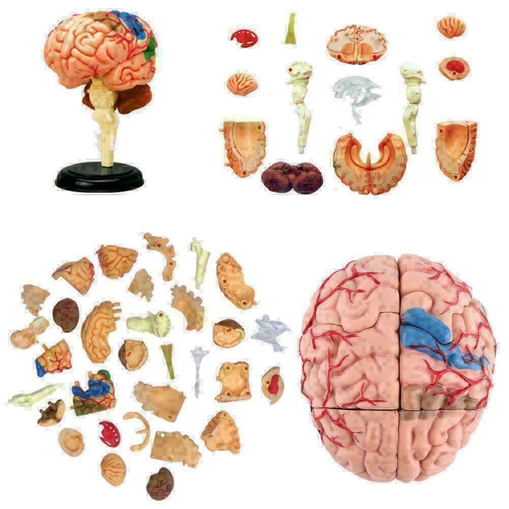 how to get harmonic brain nms